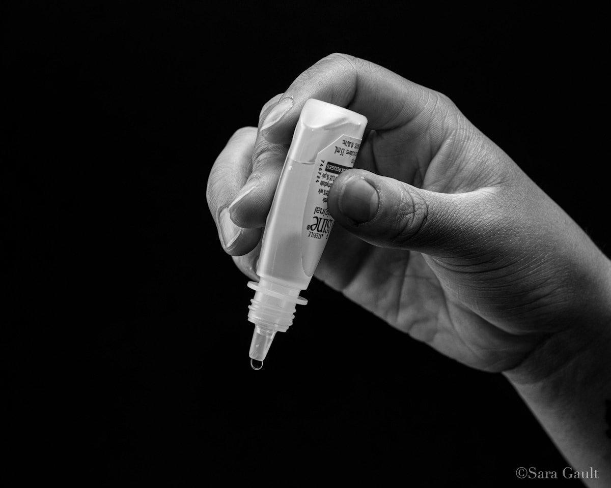 Applying artificial tears — treatment for dry eye