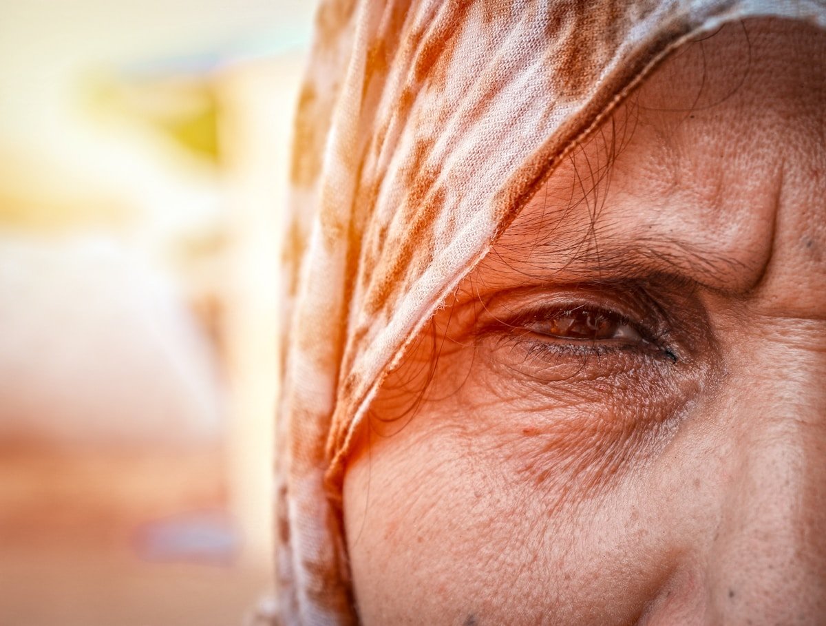 Visage marqué par l'exposition prolongée au soleil